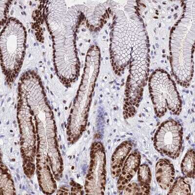 Immunohistochemistry-Paraffin: PAXX Antibody [NBP1-94172]