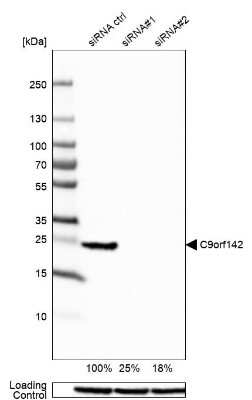 Western Blot: PAXX Antibody [NBP1-94172]