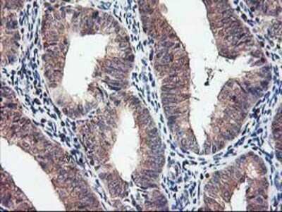 Immunohistochemistry: PBDC1 Antibody (OTI4E11) - Azide and BSA Free [NBP2-71912]