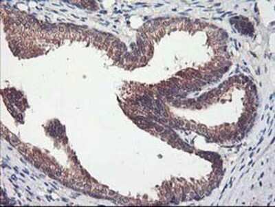 Immunohistochemistry: PBDC1 Antibody (OTI4E11) - Azide and BSA Free [NBP2-71912]