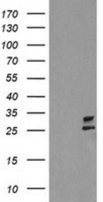 Western Blot: PBDC1 Antibody (OTI4E11)Azide and BSA Free [NBP2-71912]