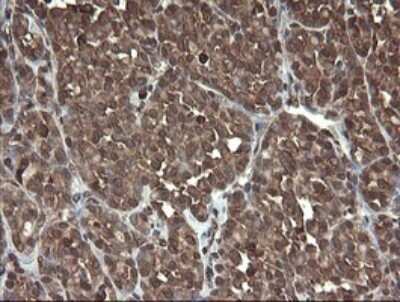Immunohistochemistry: PBDC1 Antibody (OTI5A11) - Azide and BSA Free [NBP2-71911]