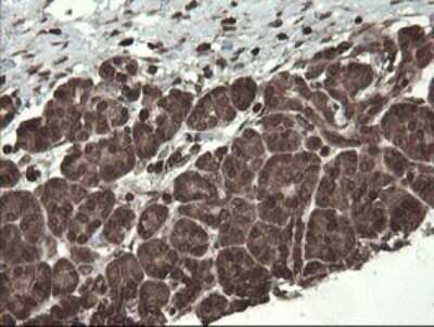 Immunohistochemistry: PBDC1 Antibody (OTI5A11) - Azide and BSA Free [NBP2-71911]
