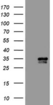 Western Blot: PBDC1 Antibody (OTI5A11)Azide and BSA Free [NBP2-71911]