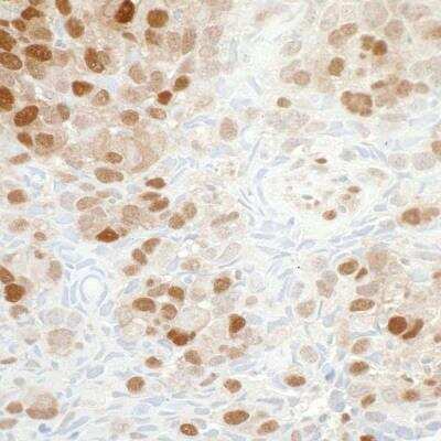 Immunohistochemistry: PBEF/Visfatin/NAMPT Antibody (BLR058F) [NBP2-76368]