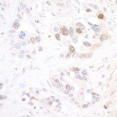 Immunohistochemistry: PBEF/Visfatin/NAMPT Antibody (BLR058F) [NBP2-76368]