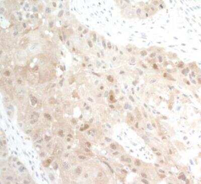 Immunohistochemistry-Paraffin: PBEF/Visfatin/NAMPT Antibody [NB100-594]