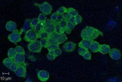 Immunocytochemistry/ Immunofluorescence: PBEF/Visfatin/NAMPT Antibody (OMNI379) - Azide and BSA Free [NBP2-80036]