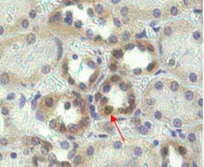 Immunohistochemistry-Paraffin: PBEF/Visfatin/NAMPT Antibody (OMNI379) - Azide and BSA Free [NBP2-80036]