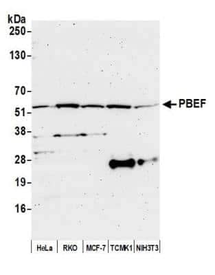 Western Blot: PBEF/Visfatin/NAMPT Antibody [NB100-594]