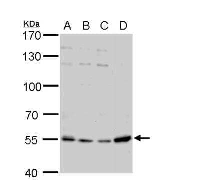 Western Blot: PBEF/Visfatin/NAMPT Antibody [NBP2-19468]