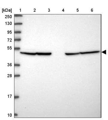 Western Blot: PBEF/Visfatin/NAMPT Antibody [NBP2-46755]