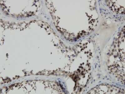 Immunohistochemistry-Paraffin: PBK Antibody (3A11) [H00055872-M11]