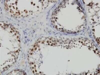 Immunohistochemistry-Paraffin: PBK Antibody (3A7) [H00055872-M07]