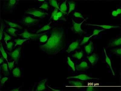 Immunocytochemistry/ Immunofluorescence: PBK Antibody (4A10) [H00055872-M06]