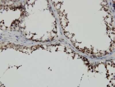 Immunohistochemistry-Paraffin: PBK Antibody (4A10) [H00055872-M06]