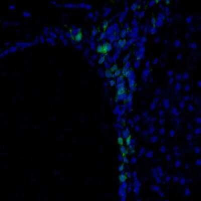Immunohistochemistry: PBK Antibody [NBP1-84342]