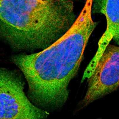 Immunocytochemistry/ Immunofluorescence: PBK Antibody [NBP1-84342]