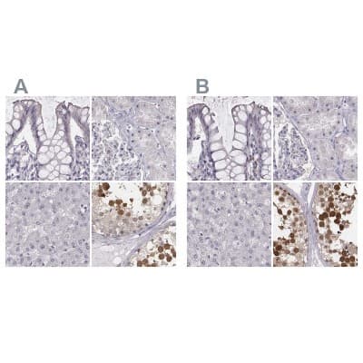 Immunohistochemistry-Paraffin: PBK Antibody [NBP1-84342]