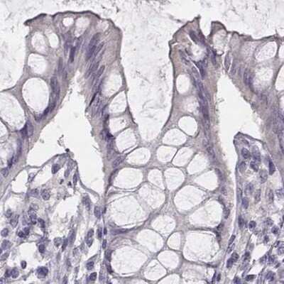 Immunohistochemistry-Paraffin: PBK Antibody [NBP1-84342]