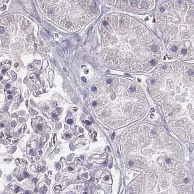 Immunohistochemistry-Paraffin: PBK Antibody [NBP1-84342]