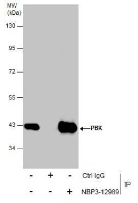 Immunoprecipitation: PBK Antibody [NBP3-12989]