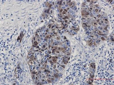 Immunohistochemistry-Paraffin: PBK Antibody (S07-0B0) [NBP3-19905]
