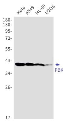 Western Blot: PBK Antibody (S07-0B0) [NBP3-19905]