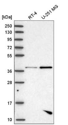 Western Blot: PBK Antibody [NBP2-58043]