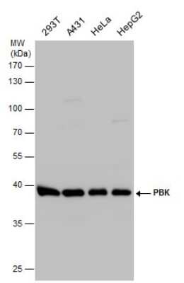 Western Blot: PBK Antibody [NBP3-12989]