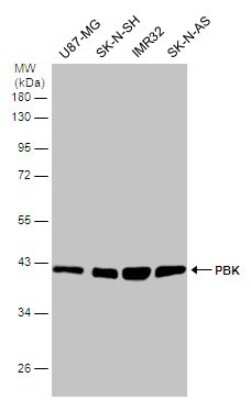 Western Blot: PBK Antibody [NBP3-12989]