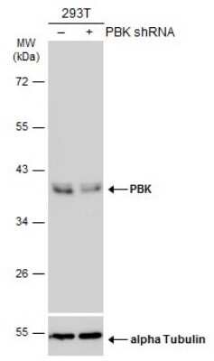 Western Blot: PBK Antibody [NBP3-12989]