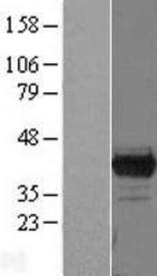 Western Blot: PBK Overexpression Lysate [NBL1-14135]