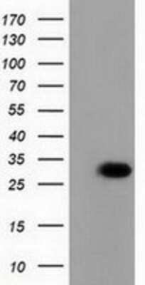 Western Blot: PBLD Antibody (OTI7G5) [NBP2-03265]