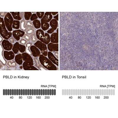 Immunohistochemistry-Paraffin: PBLD Antibody [NBP1-83682]