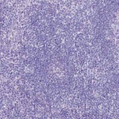 Immunohistochemistry-Paraffin: PBLD Antibody [NBP1-83683]