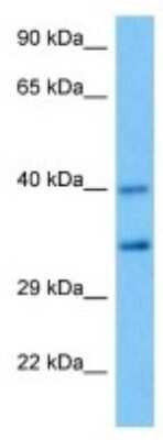 Western Blot: PBLD Antibody [NBP3-10226]