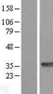 Western Blot: PBLD Overexpression Lysate [NBL1-14136]