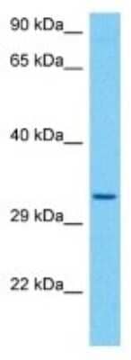 Western Blot: PBLD2 Antibody [NBP3-10260]