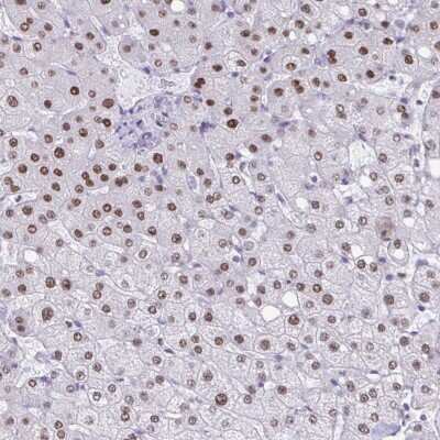 Immunohistochemistry: PBOV1 Antibody [NBP2-38982]