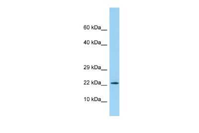 Western Blot: PBOV1 Antibody [NBP2-83368]