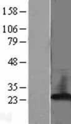 Western Blot: RKIP/PBP Overexpression Lysate [NBL1-14274]