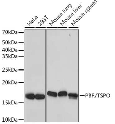 Western Blot: PBR Antibody (4I9K6) [NBP3-16497]