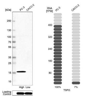 Western Blot: PBR Antibody (CL13358) [NBP3-18567]