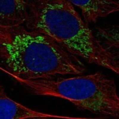 Immunocytochemistry/ Immunofluorescence: PBR Antibody [NBP3-17663]