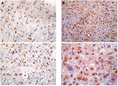 Immunohistochemistry: PBR Antibody [NB100-41398]