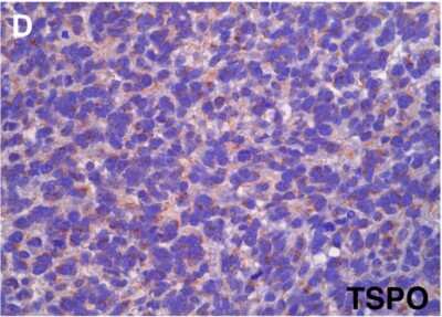Immunohistochemistry: PBR Antibody [NB100-41398]