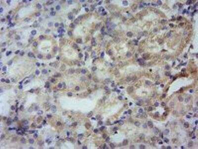 Immunohistochemistry-Paraffin: PBR Antibody [NBP1-51934]