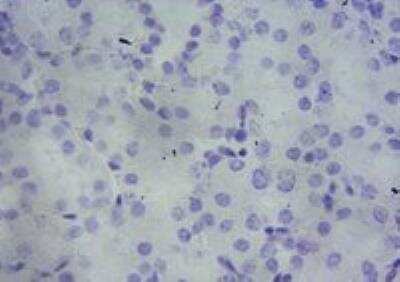 Immunohistochemistry-Paraffin: PBR Antibody [NBP1-51934]