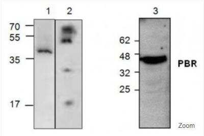 Western Blot: PBR Antibody [NBP1-45769]